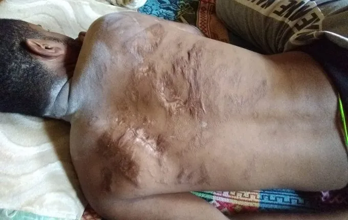 مركز حقوقي: حلّ الانتقالي لا تعفي قياداته من المسؤولية الجنائية عن جرائم الإخفاء والتعذيب
