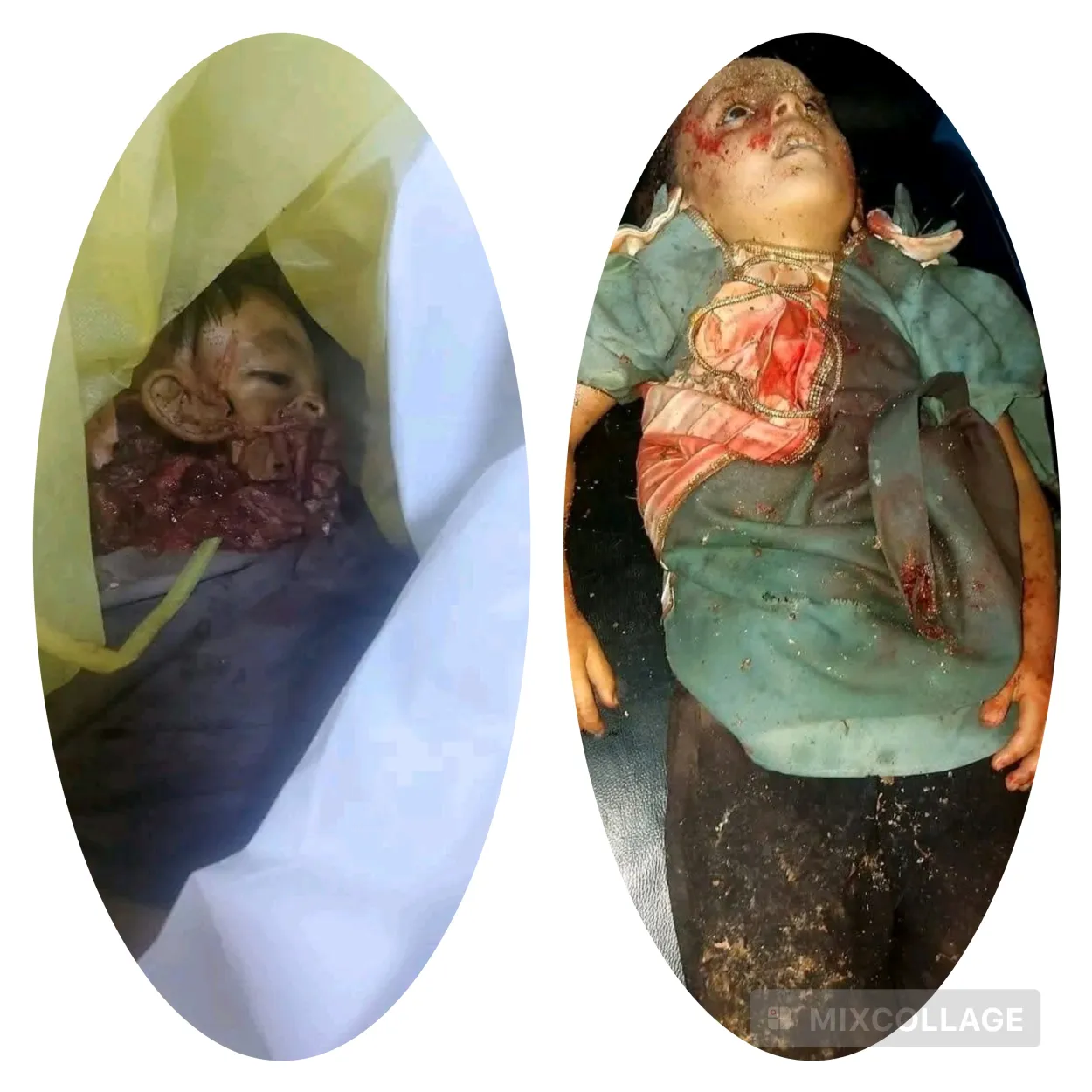 نائب مدير مكتب الصحة بحجة: أكثر من 10 قتلى بينهم أطفال في قصف حوثي استهدف مائدة إفطار بمديرية حيران